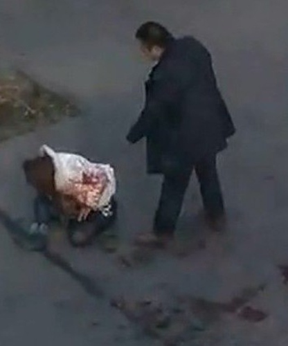 爱到浓时变成恨 女子分手被捅8刀 渣男刮一刀亲一口