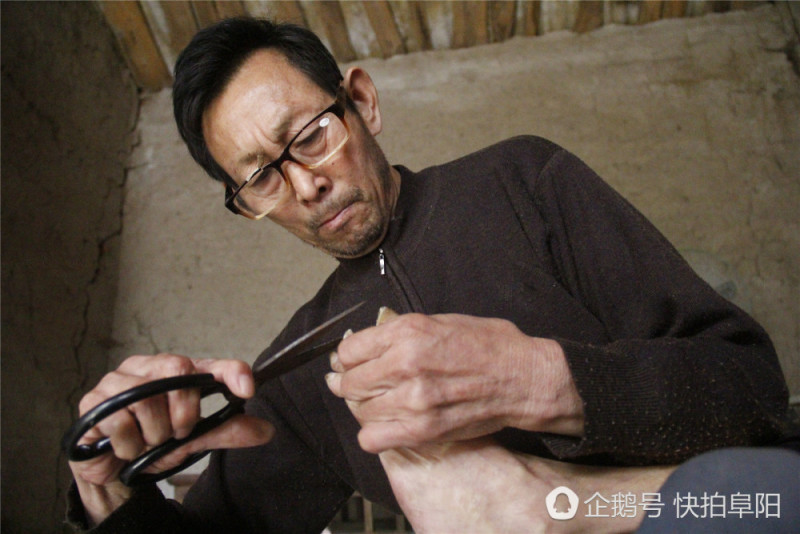 王克彬在给母亲修脚。(如果你想了解更多王克彬的故事,请关注微信公众号:阜阳快拍)