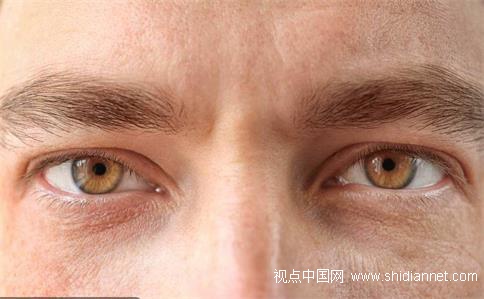 男子长期戴隐形致眼化脓:以为半年抛是半年不取