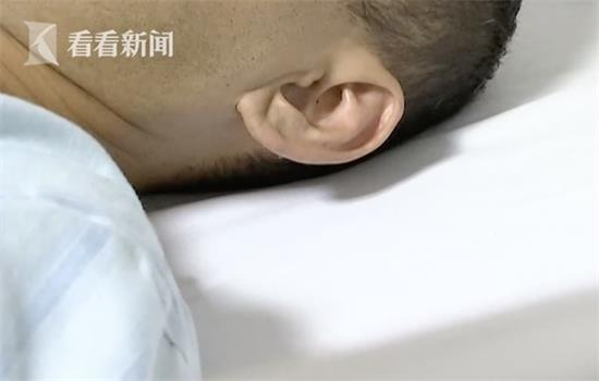 厨师徒手切猪肉被割伤 感染猪链球菌差点丧命